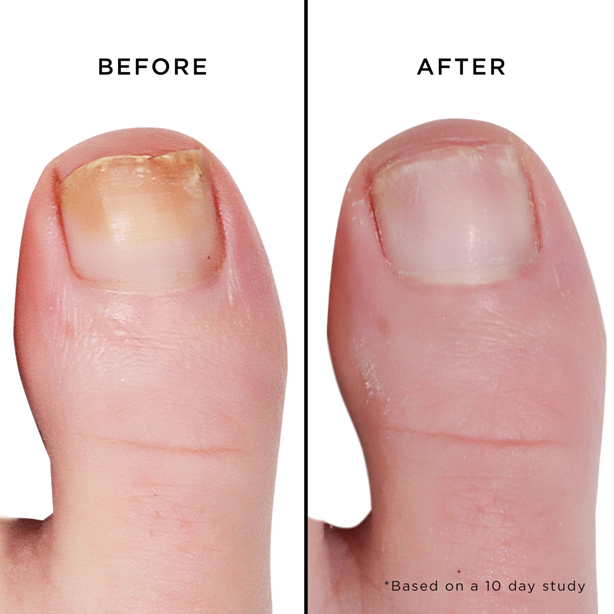 Butter London Melt Away Cuticle Exfoliator, Fashion SizeButter London811161034267Cuticle ExfoliatorCuticle Exfoliator