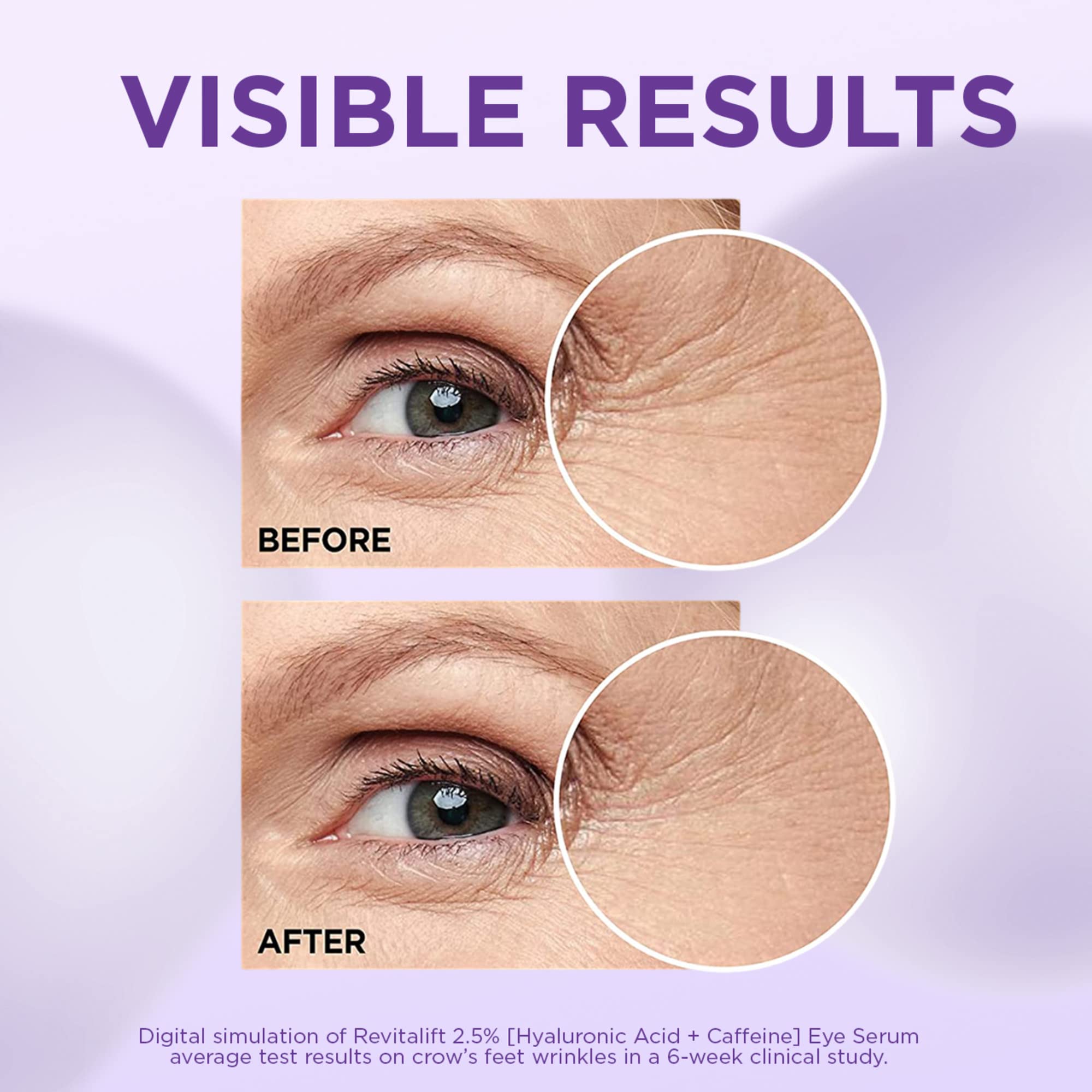 L’Oréal Paris Revitalift Triple Power LZR, Hyaluronic Acid + Caffeine Eye Serum - 20 mlL’Oréal Paris071249635452Eye SerumEye Serum